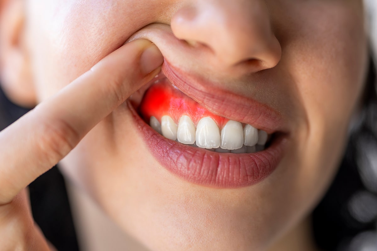 Early warning signs of gum disease you shouldnt ignore blog